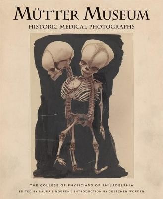 Mutter Museum Historic Medical Photographs: The College of Physicians of Philadelphia foto