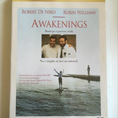 * Film DVD: Awakenings / Revenire la viata, Bazat pe o poveste reala