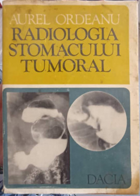 RADIOLOGIA STOMACULUI TUMORAL-AUREL ORDEANU foto