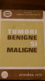 Tumori benigne si maligne G.Tarabuta-Cordun 1979