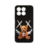 Husa BestCase&reg; Premium Silicon, Compatibila Cu Honor X8B, 1.2MM Slim, Teddy