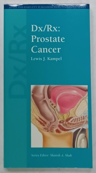 Dx/ Rx : PROSTATE CANCER by LEWIS J. KAMPEL , 2007