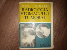 AUREL ORDEANU - RADIOLOGIA STOMACULUI TUMORAL, 1977 foto