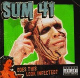 Does This Look Infected? | Sum 41, Island Records