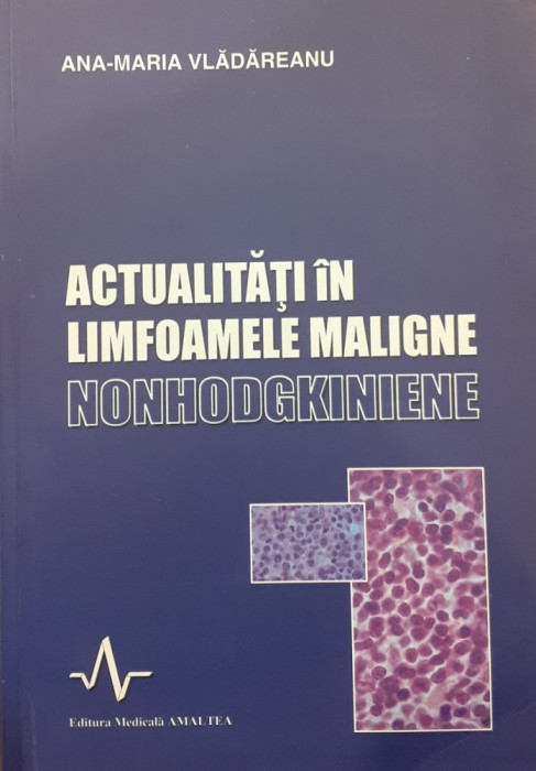 Actualitati in limfoamele maligne nonhodgkiniene