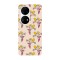 Husa compatibila cu Huawei P40 model DeeDee Pattern, Silicon, TPU, Viceversa