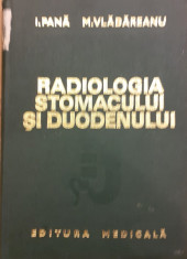 Radiologia stomacului si duodenului foto