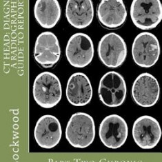 CT Head: Diagnosis a Radiographers Guide to Reporting Part 2 Chronic Pathologies: Part 2 Chronic Pathologies