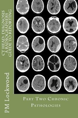 CT Head: Diagnosis a Radiographers Guide to Reporting Part 2 Chronic Pathologies: Part 2 Chronic Pathologies foto