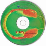 CD Andyshiva - X-Ray Compilatie Original Stare Foarte Buna (Fara Coperta Spate)