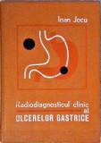 Radiodiagnosticul Clinic al Ulcerelor Gastrice - Ioan Jocu, 1976, Editura Medicala, Carte Medicina, Hardcover