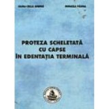 Proteza scheletata cu capse in edentatia terminala - Mihaela Pauna