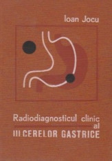 Radiodiagnosticul clinic al ulcerelor gastrice foto