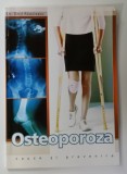 OSTEOPOROZA , CAUZE SI PREVENIRE de Dr. EMIL RADULESCU , 2004