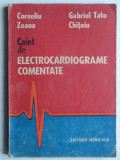 Caiet de electrocardiograme comentate - Corneliu Zeana