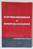 ELECTROCARDIOGRAMA IN REPERFUZIA MIOCARDICA de Dr. GABRIEL TATU - CHITOIU , 2014 , PREZINTA HALOURI DE APA SI URME DE INDOIRE