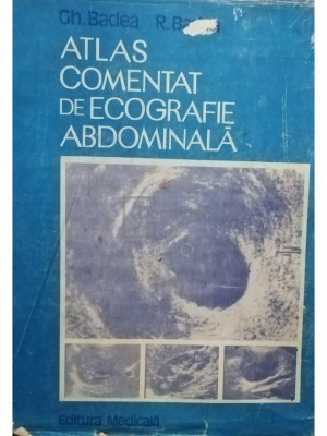 Gh. Badea - Atlas comentat de ecografie abdominală (editia 1990) foto