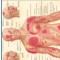 Trigger Points