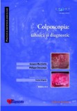 Colposcopia: tehnica si diagnostic | Jacques Marchetta, Philippe Descamps