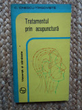 TRATAMENTUL PRIN ACUPUNCTURA - C. IONESCU TIRGOVISTE