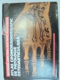 ATLAS CROMORADIOGRAFIC DE PATOLOGIE OSTEOARTICULARA BUCURESTI 1978