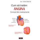 Cum sa tratam angina - Dr. Tom Smith, 2007, Antet