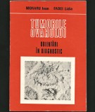 Cumpara ieftin TUMORILE OVARULUI - ORIENTĂRI &Icirc;N DIAGNOSTIC - IOAN MORARU, FADEI LIDIA