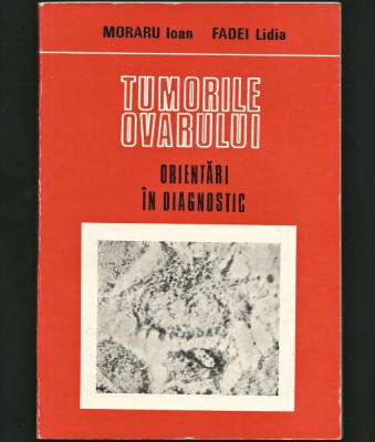 TUMORILE OVARULUI - ORIENTĂRI &amp;Icirc;N DIAGNOSTIC - IOAN MORARU, FADEI LIDIA foto