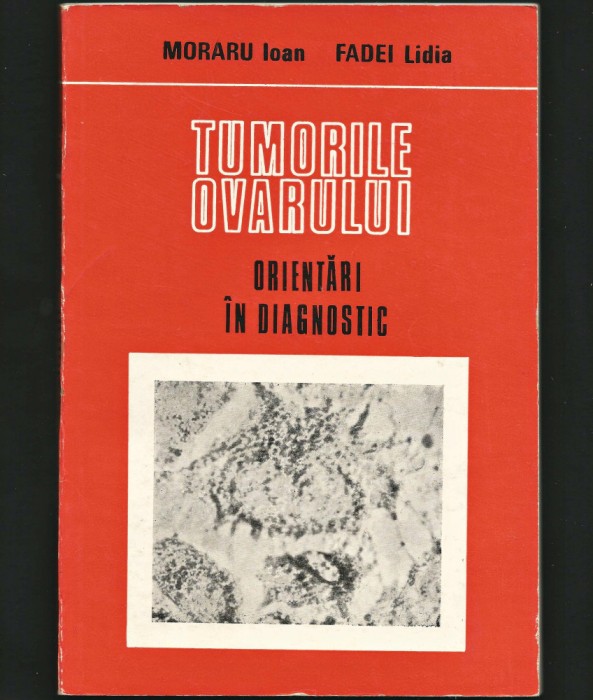 TUMORILE OVARULUI - ORIENTĂRI &Icirc;N DIAGNOSTIC - IOAN MORARU, FADEI LIDIA