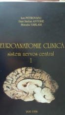 Neuroanatomie clinica Sistem nervos central-Ion Petrovanu, foto