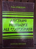 Afectiuni nelitiazice ale colecistului - Ioan Paraian