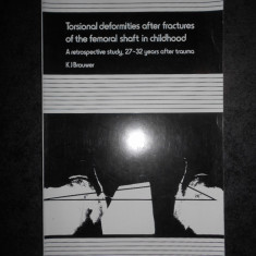 TORSIONAL DEFORMITIES AFTER FRACTURES OF THE FEMORAL SHAFT IN CHILDHOOD (1981)