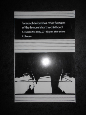 TORSIONAL DEFORMITIES AFTER FRACTURES OF THE FEMORAL SHAFT IN CHILDHOOD (1981) foto