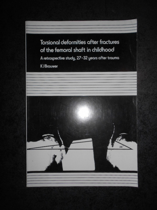 TORSIONAL DEFORMITIES AFTER FRACTURES OF THE FEMORAL SHAFT IN CHILDHOOD (1981)