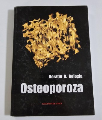 Carte: Osteoporoza foto