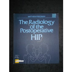MATTHEW FREEDMAN - THE RADIOLOGY OF THE POSTOPERATIVE HIP (editie cartonata)
