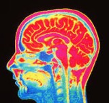 Dana Codruta Purcia - Probleme de neuropsihofiziologie