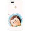 Husa silicon pentru Xiaomi Mi A1, Arici