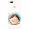 Husa silicon pentru Xiaomi Mi A1, Arici
