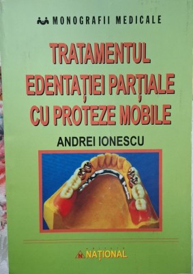 Tratamentul Edentatie Totale cu Proteze Mobile foto