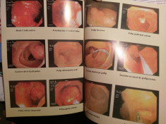 Endoscopia digestiva-principii diagnostice si tehnici terapeutice an 2010 foto