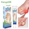 KanyeHB*2 buc. Cremă inflamatii articulatii degete, monturi, guta, reparatorie