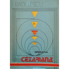 Operatia Cezariana - I. Radulescu , B1102