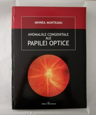 Anomaliile congenitale ale papilei optice, Mihnea Munteanu, 2008 foto