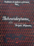 Electrocardiograma - 1978 - Georgeta Scripcaru (@B157)