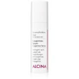 Alcina For Sensitive Skin Ser pentru a reduce venele și &icirc;nroșirea pielii 30 ml