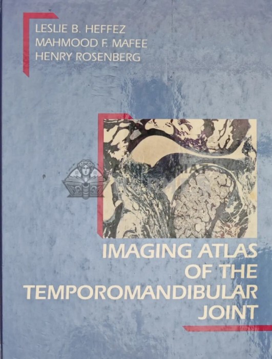 Imaging Atlas of the Temporomandibular Joint - 1995 - Henry Rosenberg (Y241)