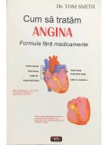 Tom Smith - Cum sa tratam angina (Editia: 2007)