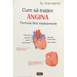 Tom Smith - Cum sa tratam angina (Editia: 2007)