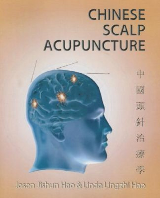 Chinese Scalp Acupuncture foto